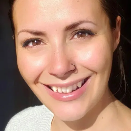 Sonrisa de mujer joven antes del tratamiento de ortodoncia