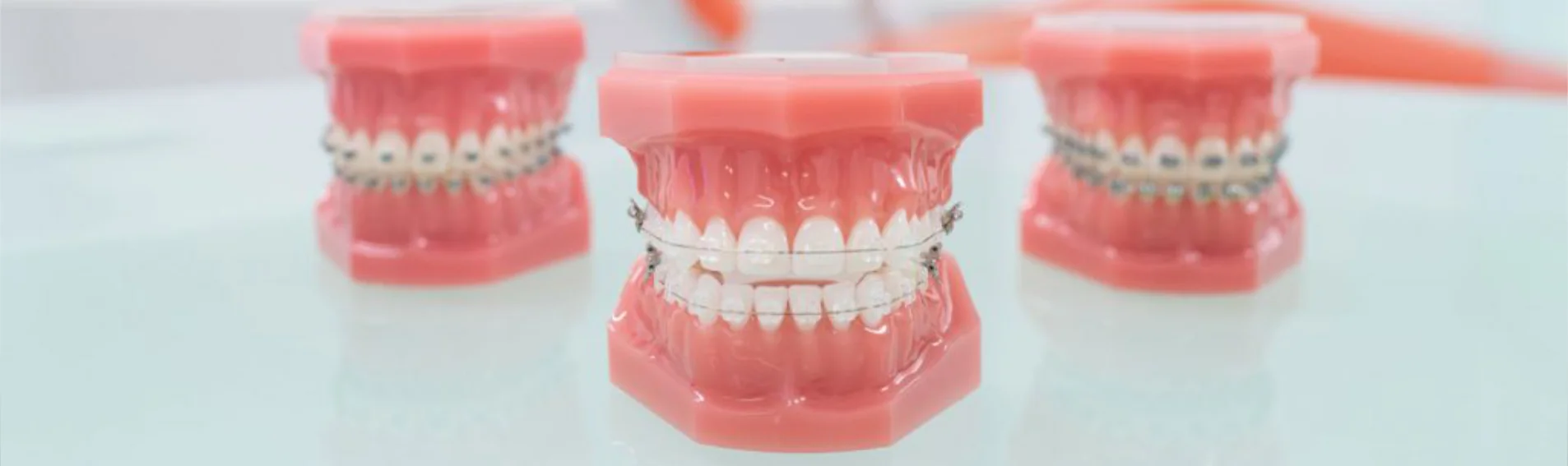 Consulta de ortodoncia en Ivaskevich Design Odontología, Encarnación